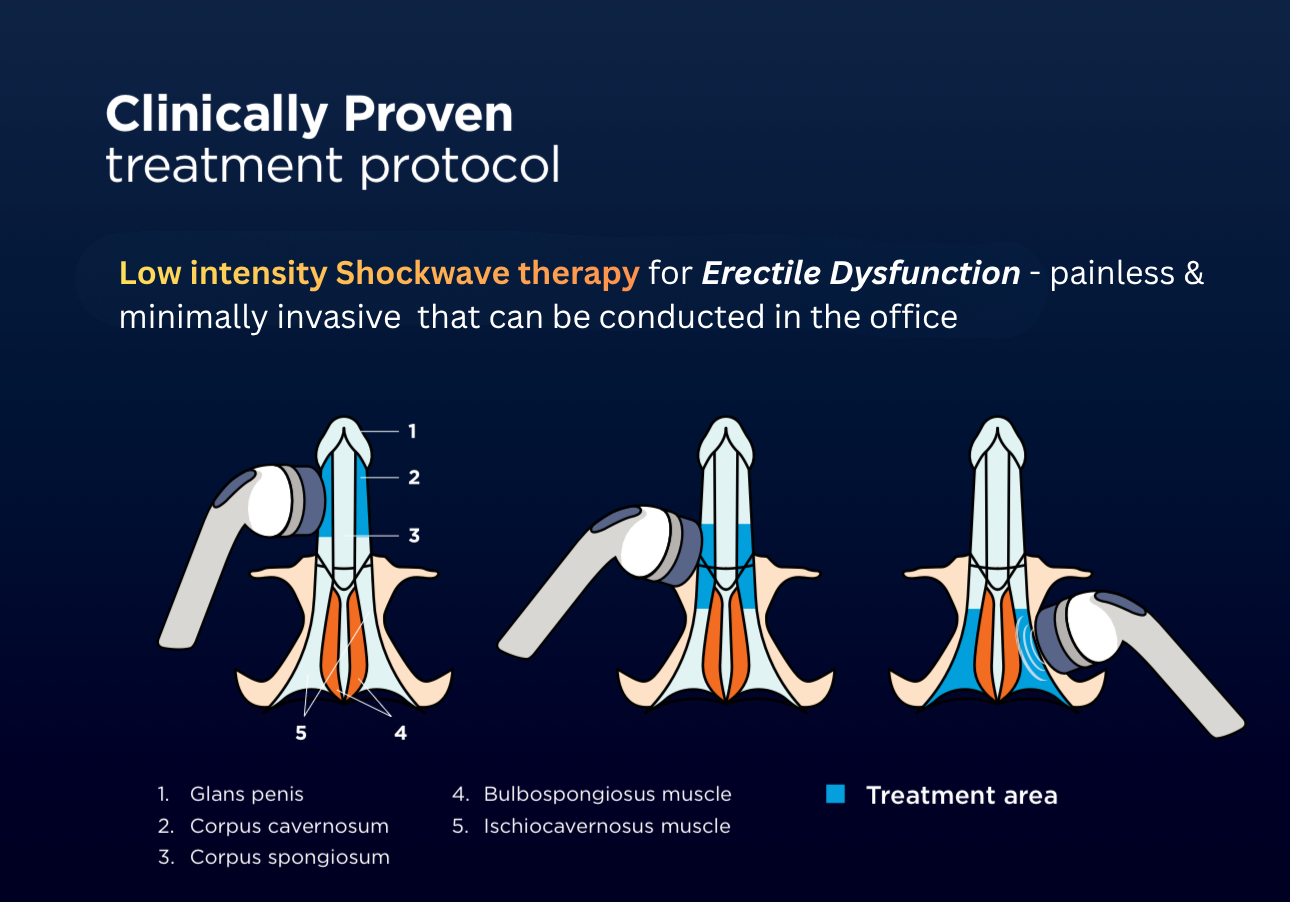 Shockwave therapy for Erectile dysfunction - Pantai Hospital Penang