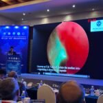 Lijiang Golden Bridge Conference Blue Laser Surgery Presentation - Dr. William Ong